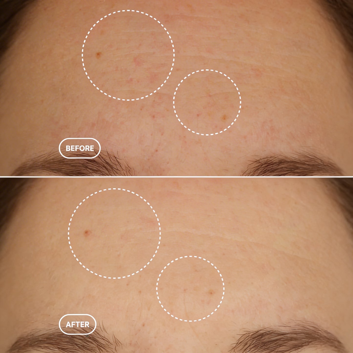 Noren | R1™ Retinol Alternative Serum