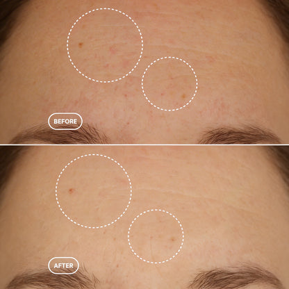 Noren | R1™ Retinol Alternative Serum